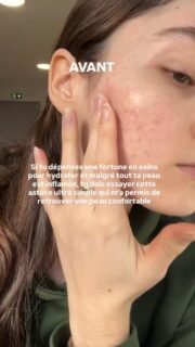 On nous ment quand on nous dit qu’il faut “plus d’hydratation” ❌Ce n’est pas le manque d’eau le vrai problème.C’est l’incapacité de la peau (ou du cheveu) à la retenir.Tu peux hydrater encore et encore,si l’eau s’évapore aussitôt,tu recommenceras indéfiniment… sans résultats durables.C’est là que tout devient contre-intuitif.👉 Ce qui permet de garder l’hydratation,ce n’est pas l’eau.C’est le gras.La peau et la fibre capillaire ont besoin de lipidespour créer une barrière protectrice,celle qui empêche l’eau de s’échapper.Sans cette barrière :– la peau tiraille (surtout en hiver, je sais de quoi je parle)– le cheveu devient sec, mousseux, terne– l’hydratation ne tient jamaisEt non, toutes les huiles ne se valent pas.J’en ai testé beaucoup.Certaines trop lourdes, d’autres qui restaient en surface, ou qui étouffaient plus qu’elles ne protégeaient.Des huiles comme l’huile de pépins de figue de barbarie, un véritable trésor du Maroc, utilisée depuis des générations pour protéger la peau du soleil, du vent, du temps.Naturellement riche en acides gras essentiels et en antioxydants,
elle mime le sébum de la peau, sans la saturer.
C’est avec ce type d’huile-là que j’ai vu la différence.Résultat :✔️ une peau qui ne tiraille plus avec le froid✔️ une peau souple, confortable, qui reste douce du matin au soir✔️ plus besoin de remettre de la crème plusieurs fois par jour👉 Et vous, vous utilisez déjà des huiles dans vos routines ? Avez-vous déjà testé l’huile de pépins de figues de barbarie ?#huilesvegetales #hydratation #cosmetiquesnaturels