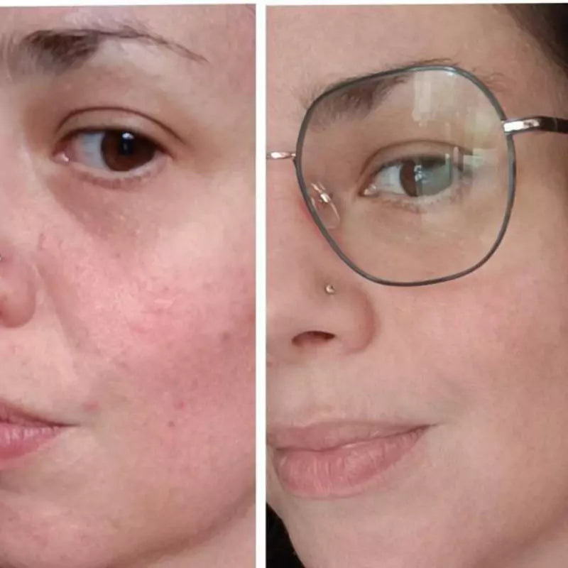 ROUTINE ANTI-IMPERFECTIONS – Peau sèche à sensible