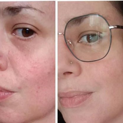 ROUTINE ANTI-IMPERFECTIONS – Peau sèche à sensible