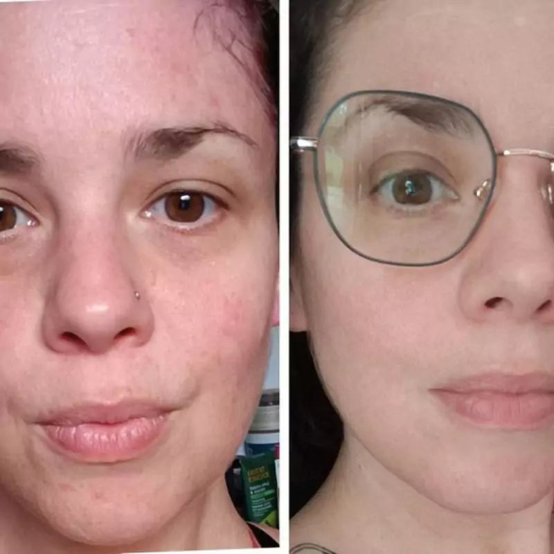 ROUTINE ANTI-IMPERFECTIONS – Peau sèche à sensible