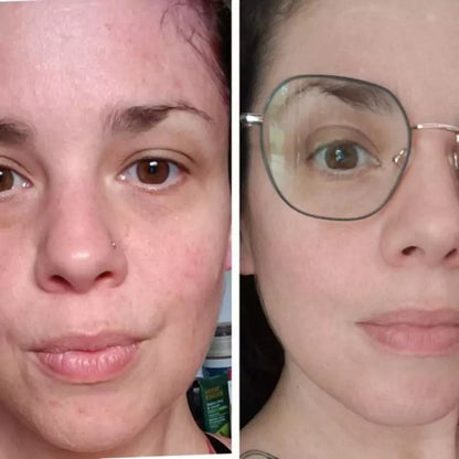 ROUTINE ANTI-IMPERFECTIONS – Peau sèche à sensible