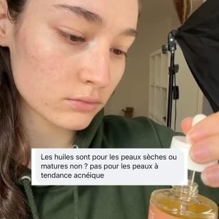 Et vous les huiles, adoptées ou pas ? 🥰 Racontez-moi 👇#peausensible #peaudouce #peaugrasse #huiledargan #sérum #aquiliacosmetics #huilevégétale #huiledepépinsdefiguedebarbarie #maroc